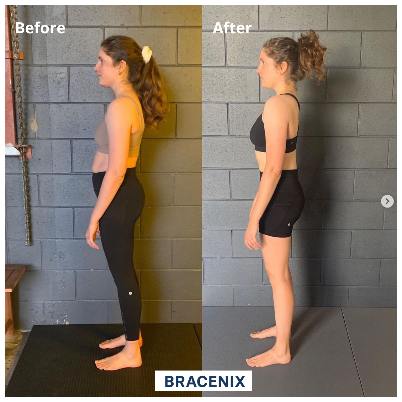 Bracenix™ Posture Corrector Brace