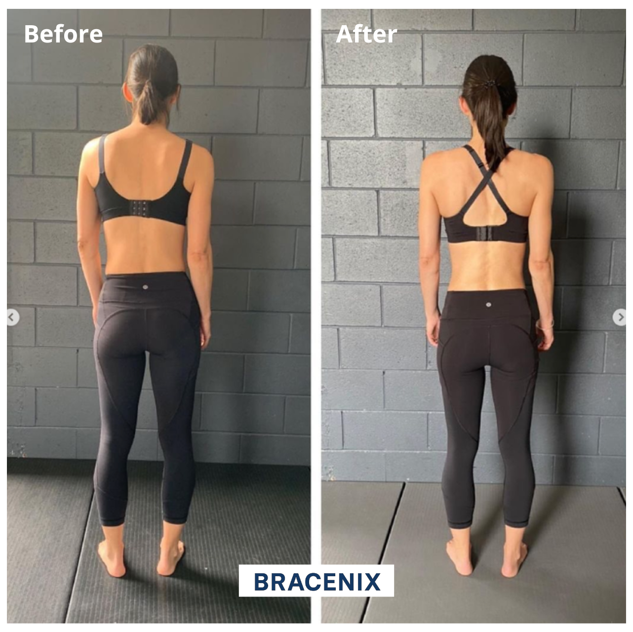 Bracenix™ Posture Corrector Brace