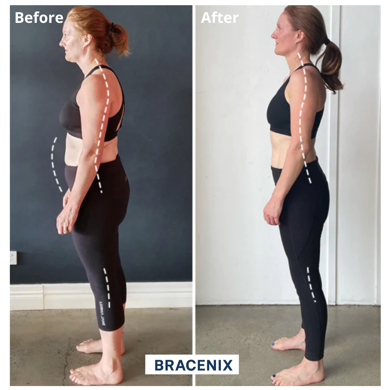 Bracenix™ Posture Corrector Brace