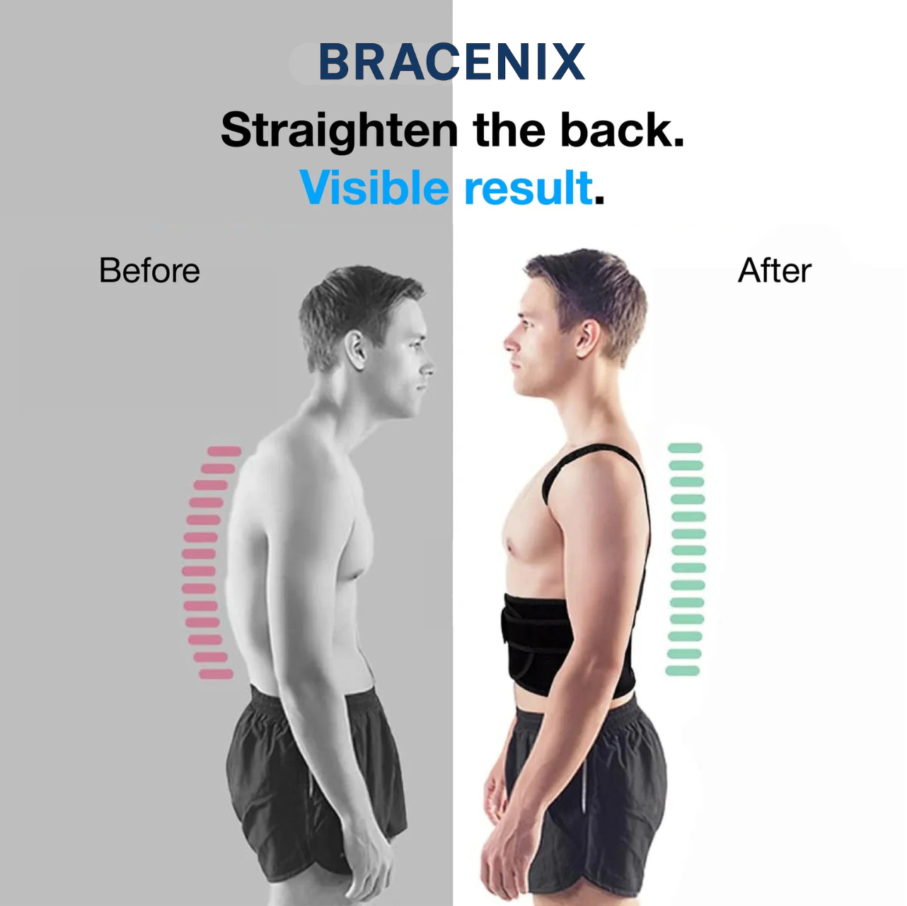 Bracenix™ Posture Corrector Brace